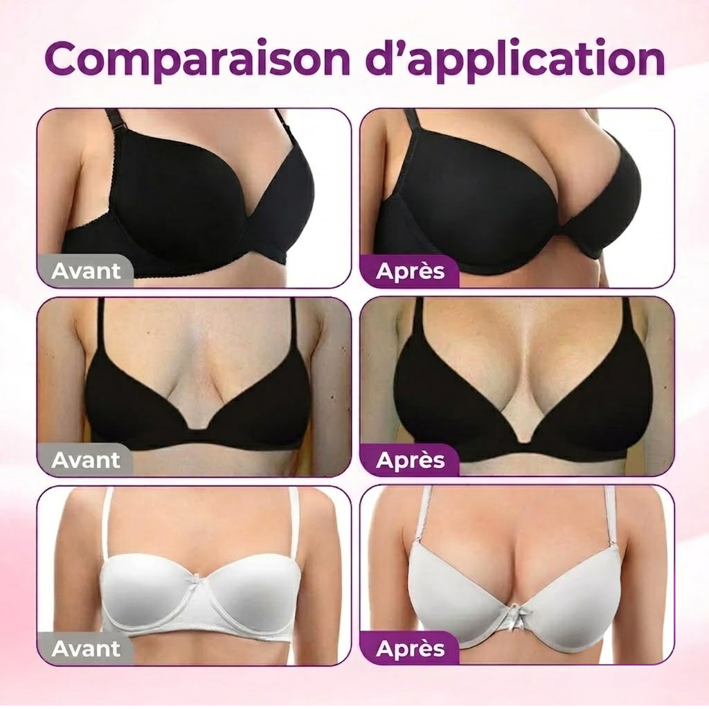 🍒Turonu® Patch Volumateur & Galbant Poitrine — Micro-Aiguilles Dissolvantes pour un Décolleté Plus Volumineux, Ferme et Rehaussé