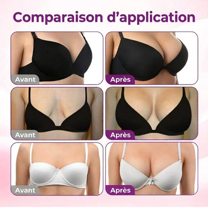 🍒Turonu® Patch Volumateur & Galbant Poitrine — Micro-Aiguilles Dissolvantes pour un Décolleté Plus Volumineux, Ferme et Rehaussé